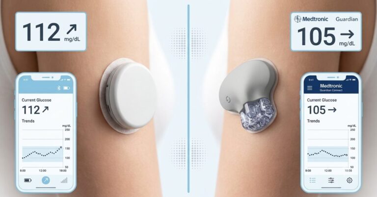 FreeStyle Libre vs Medtronic Guardian